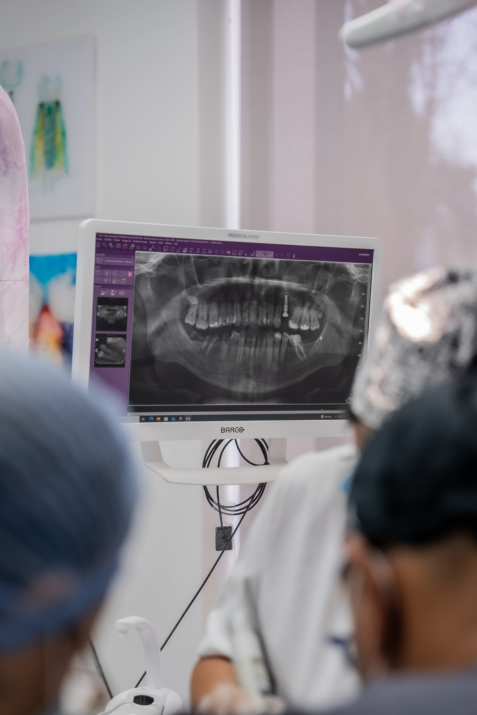 Scanner 3D - Bilan complet